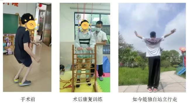 廣東2024年“明天計(jì)劃”撥付省級(jí)福彩公益金808萬(wàn)元